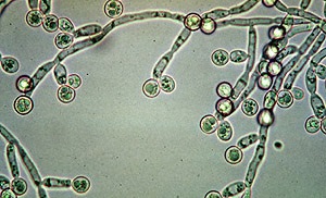 Candida Infection